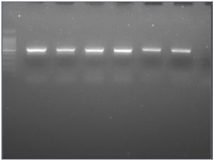 Gel electrophoresis